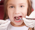 Increasing Access to Dental Care